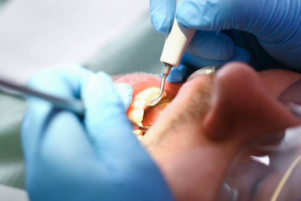 Best Emergency Treatment for Oral Infections in St Joseph, MI