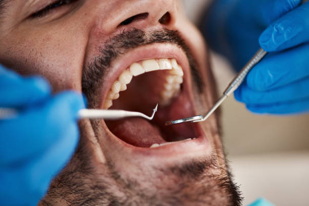 Best Emergency Treatment for Oral Infections in St Joseph, MI