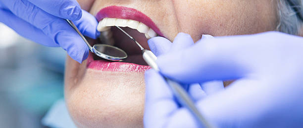 Best Lost Filling or Crown Replacement in St Joseph, MI