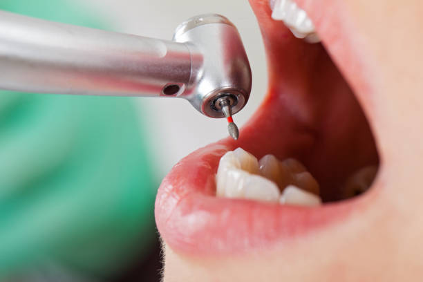 Best Emergency Root Canal Therapy in St Joseph, MI